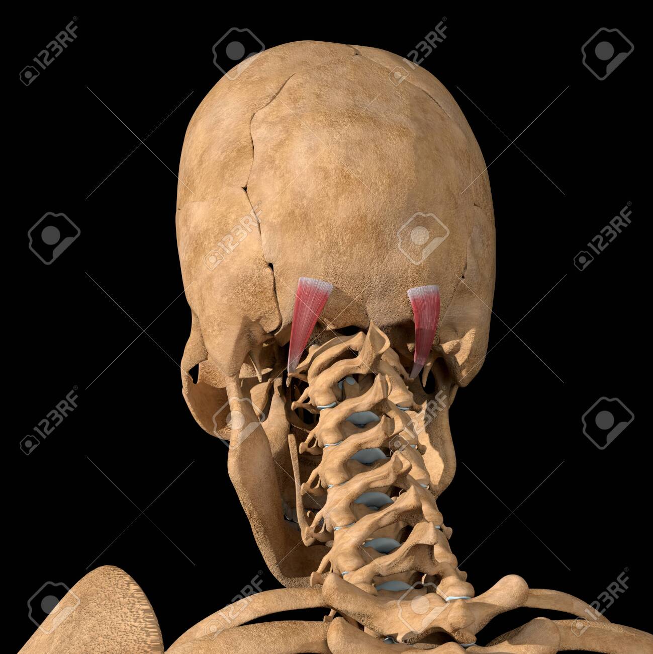 This 3d illustration shows the obliquus capitis superior muscles on skeleton - 141536829 This 3d illustration shows the obliquus capitis superior muscles on skeleton - 141536829