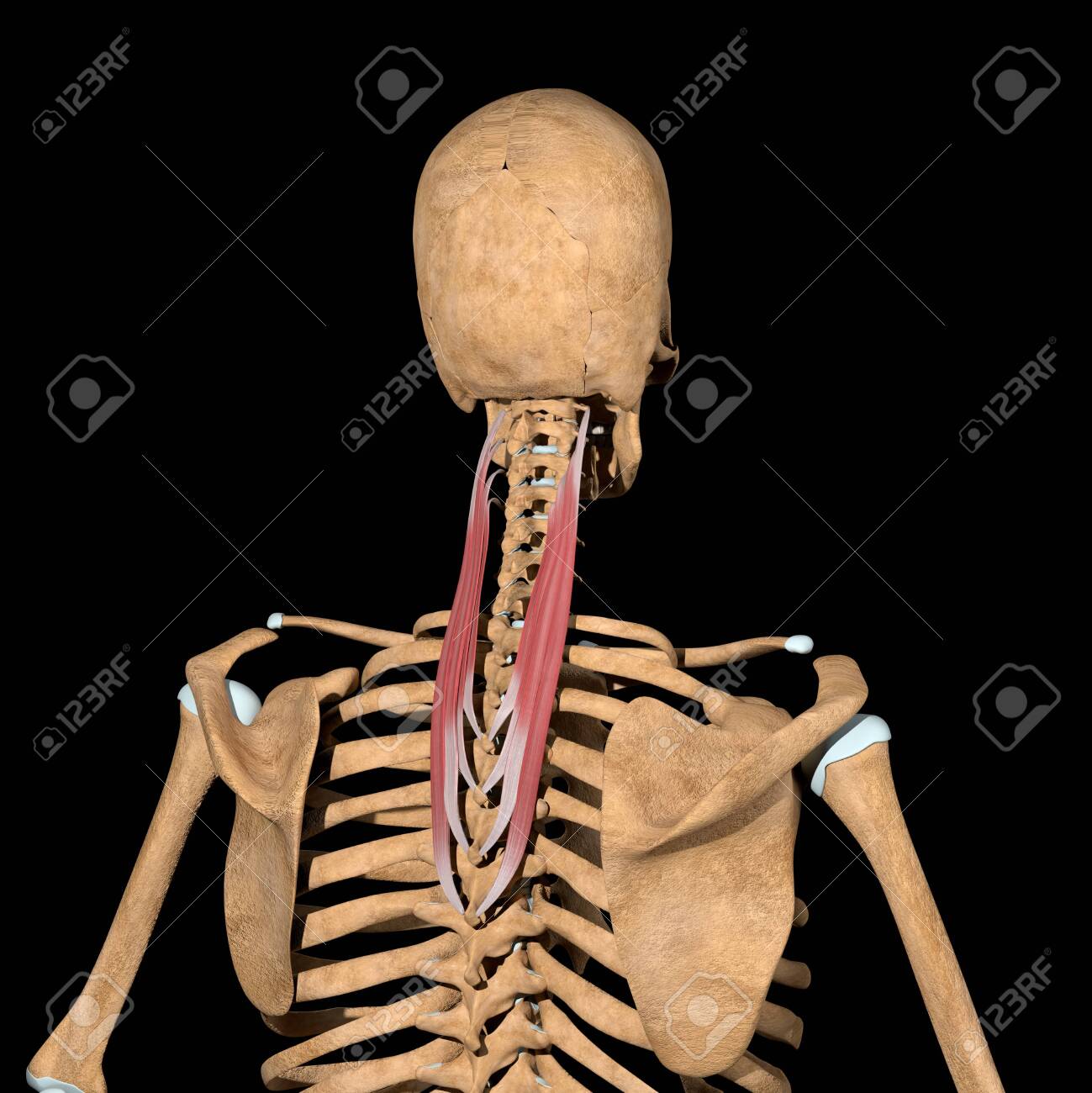 This 3d illustration shows the splenius cervicis muscles on skeleton - 142009944 This 3d illustration shows the splenius cervicis muscles on skeleton - 142009944