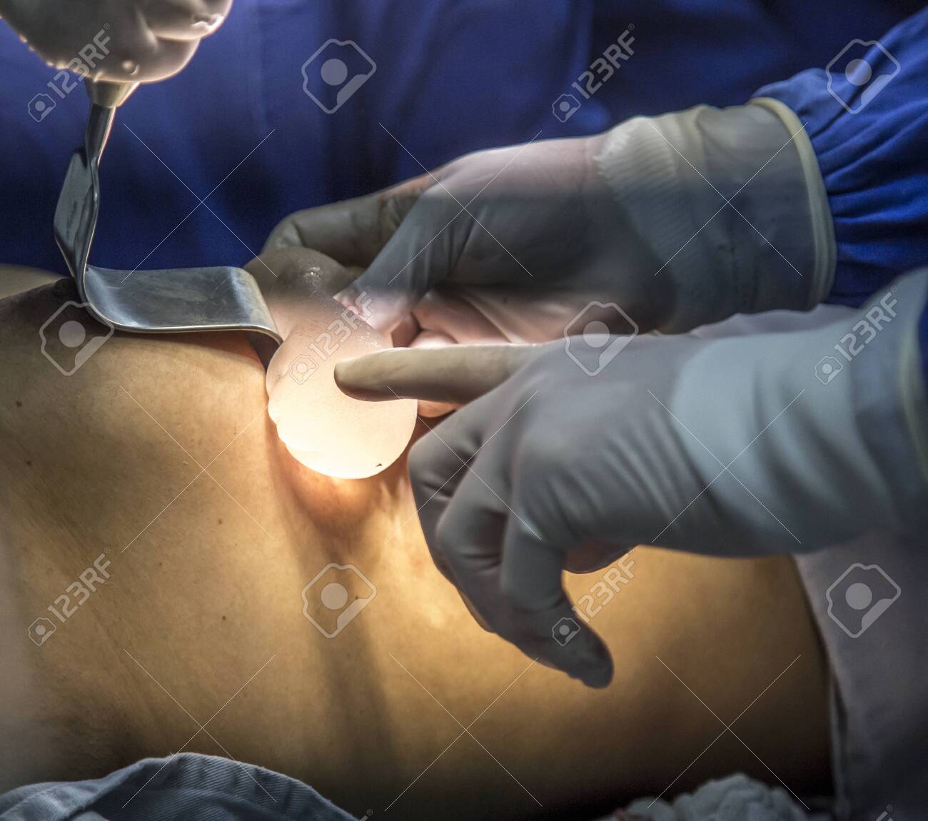 etiam-dictum-ipsum-a-felis