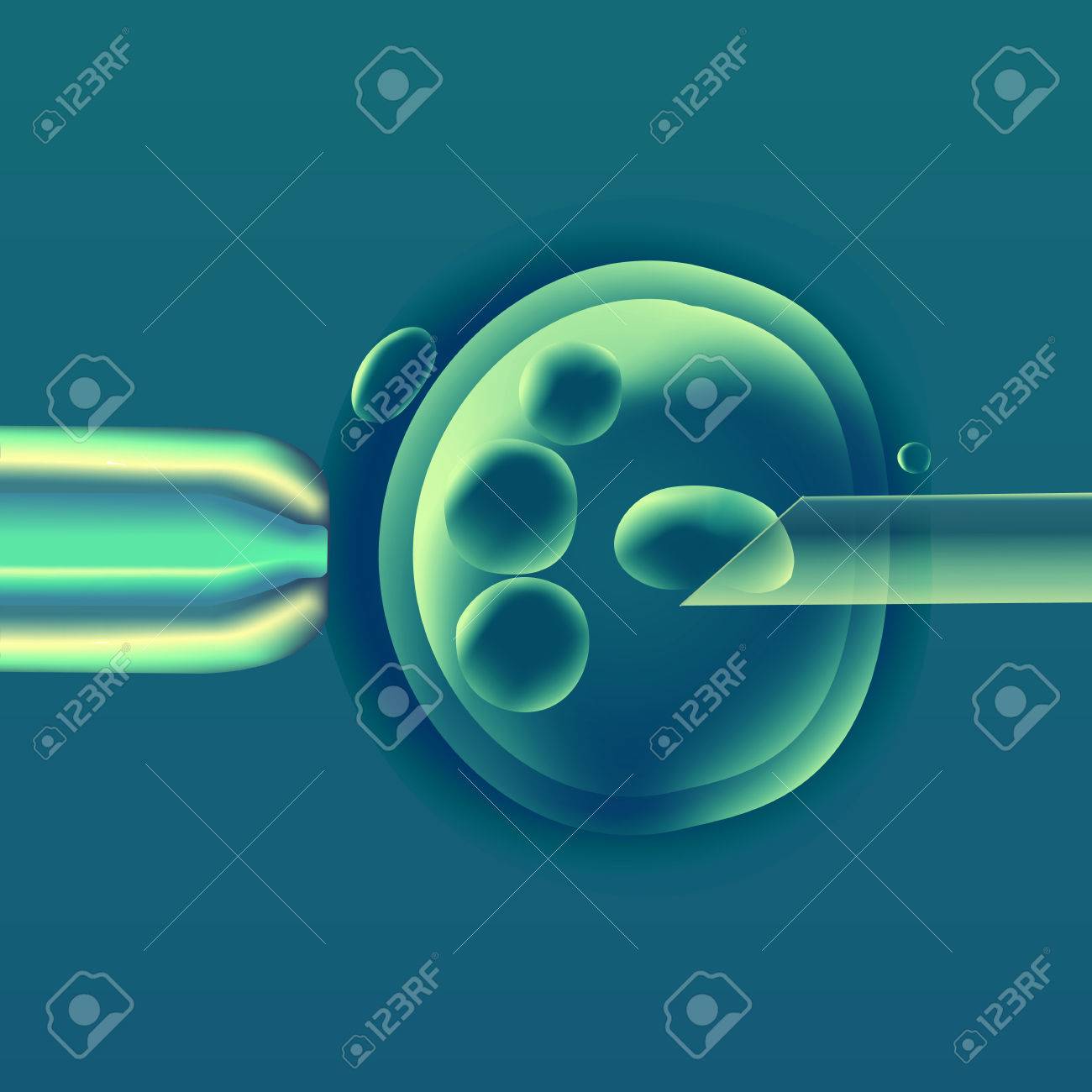 体外受精 Ivf では 卵の卵子 ピペットおよびパイプ水平 人間記事 サイトやタイポグラフィの雑誌 パンフレット チラシ ポスター カラフルなイラスト で再現 のイラスト素材 ベクタ Image 体外受精 Ivf では 卵の卵子 ピペットおよびパイプ水平 人間記事 サイトやタイポグラフィの雑誌 パンフレット チラシ ポスター カラフルなイラスト で再現 のイラスト素材 ベクタ Image