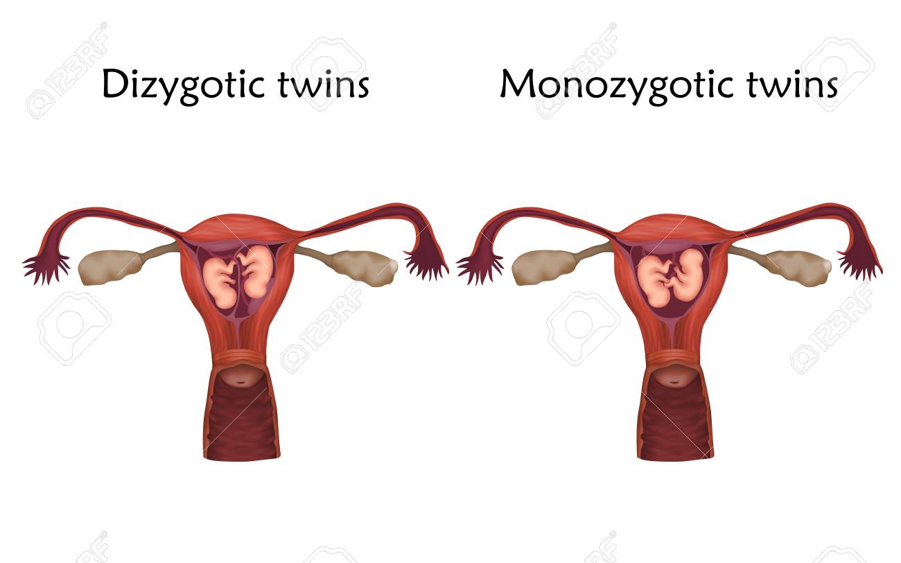 Image result for Monozygotic