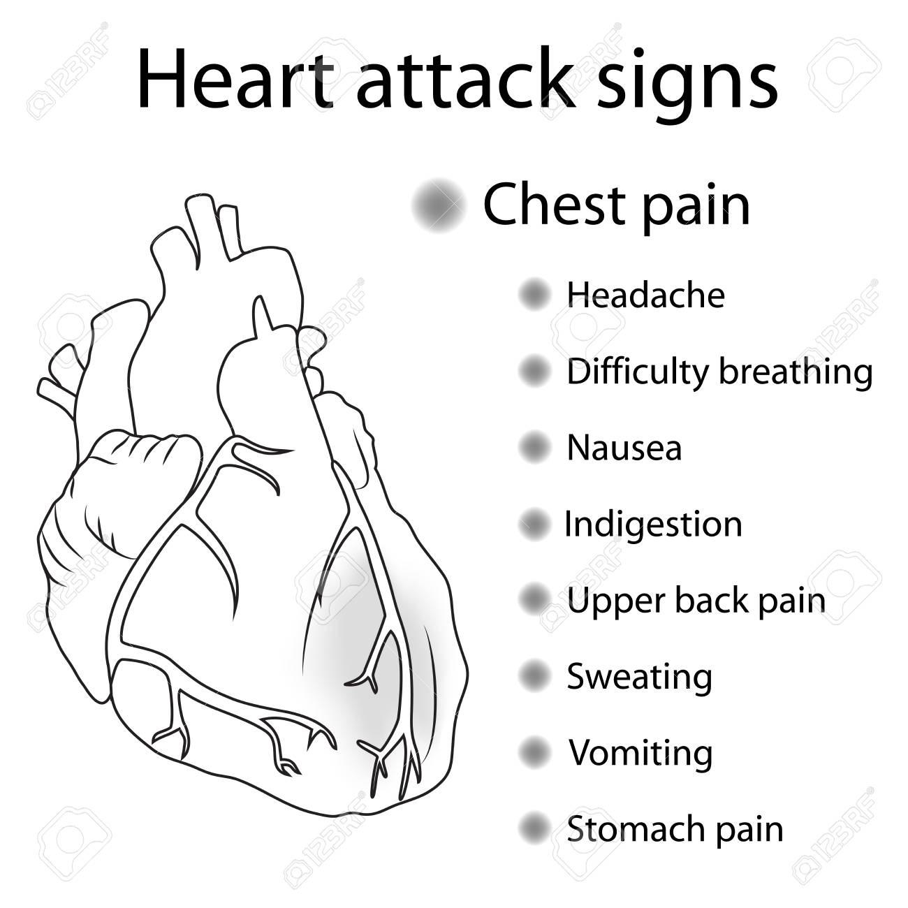 Heart Attack Signs Symptoms Myocardial Infarction Damaged Royalty Free Cliparts Vectors And Stock Illustration Image 127384289