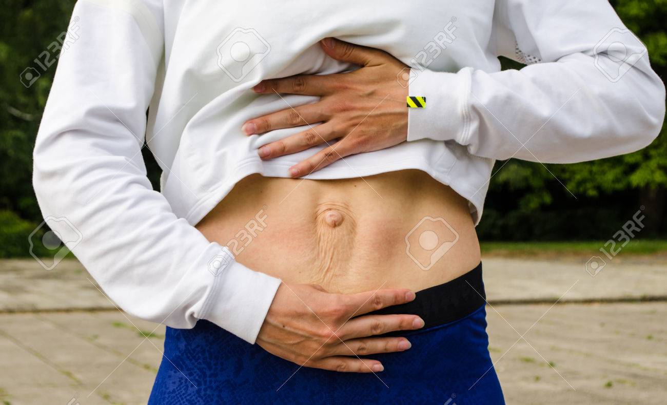 腹壁披裂の整流器です 腹部の筋肉の妊娠や出産後の女性の腹部発散 の写真素材 画像素材 Image