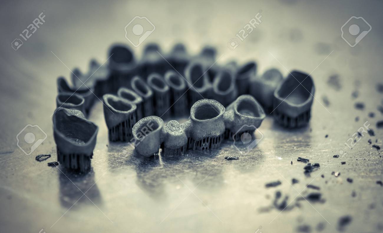 металлические коронки лазерное спекание. лазерное спекание металла в стоматологии. зуботехническое литье. лазерное спекание в стоматологии. селективное лазерное спекание в стоматологии.