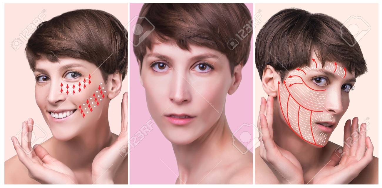 Stock Photo