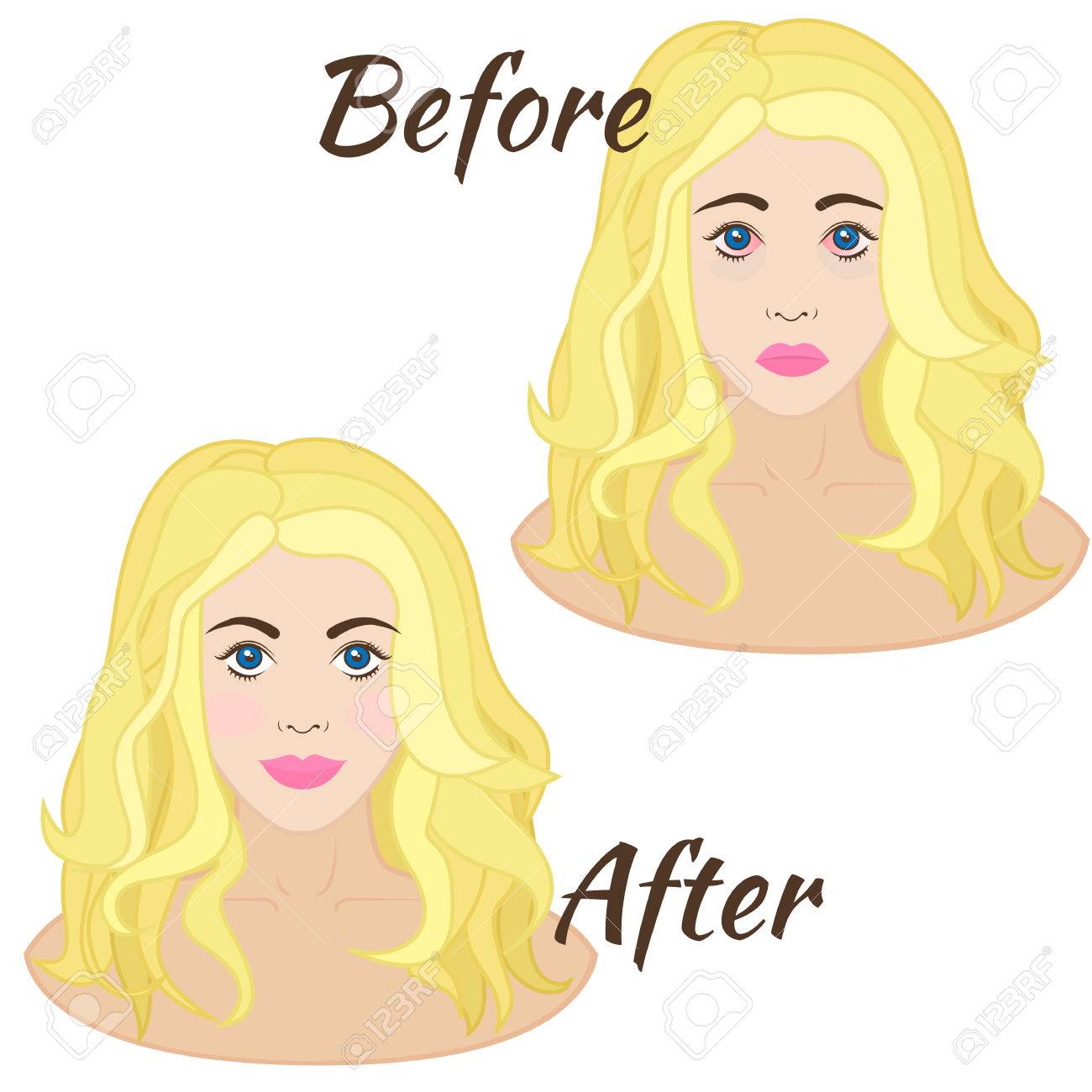 Girl With Red Eyes, Eye Disease Or Allergies Royalty Free SVG, Cliparts,  Vectors, and Stock Illustration. Image 30029079., image size:1300x1300