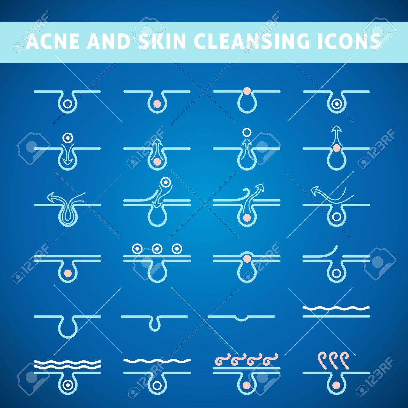 icon acne, schematic view of a skin care, problem skin with acne in section - 47006921 icon acne, schematic view of a skin care, problem skin with acne in section - 47006921