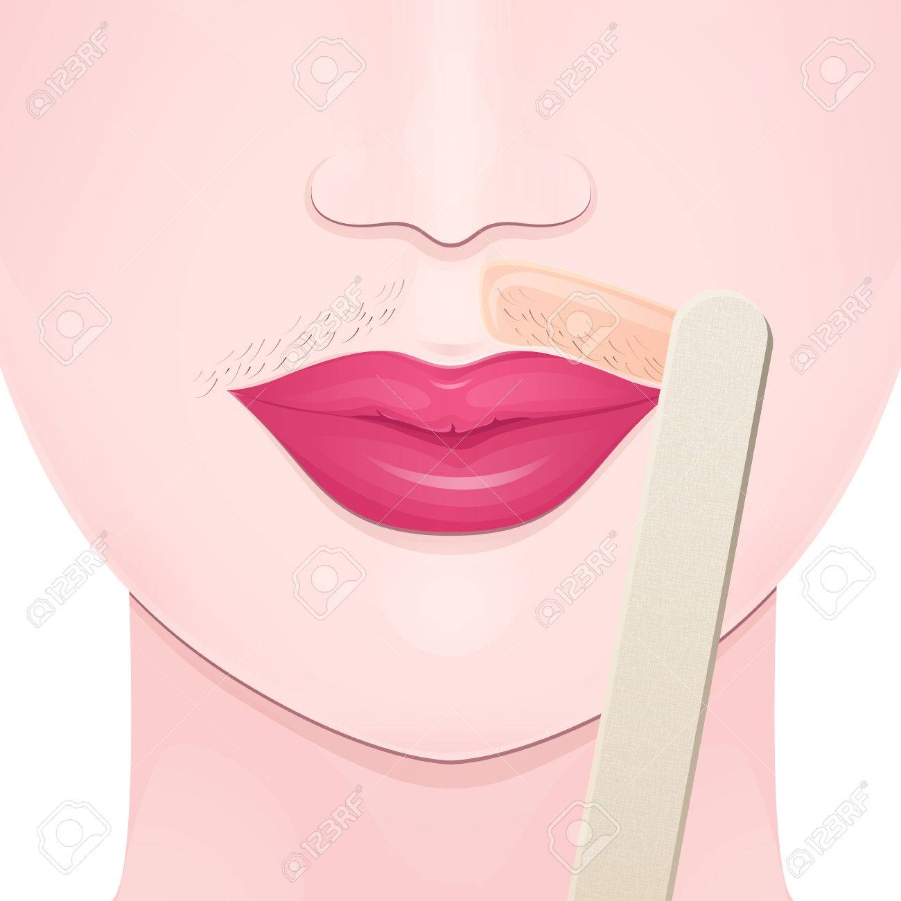 Mustache On The Upper Lip Of A Woman Hair Removal Wax Royalty
