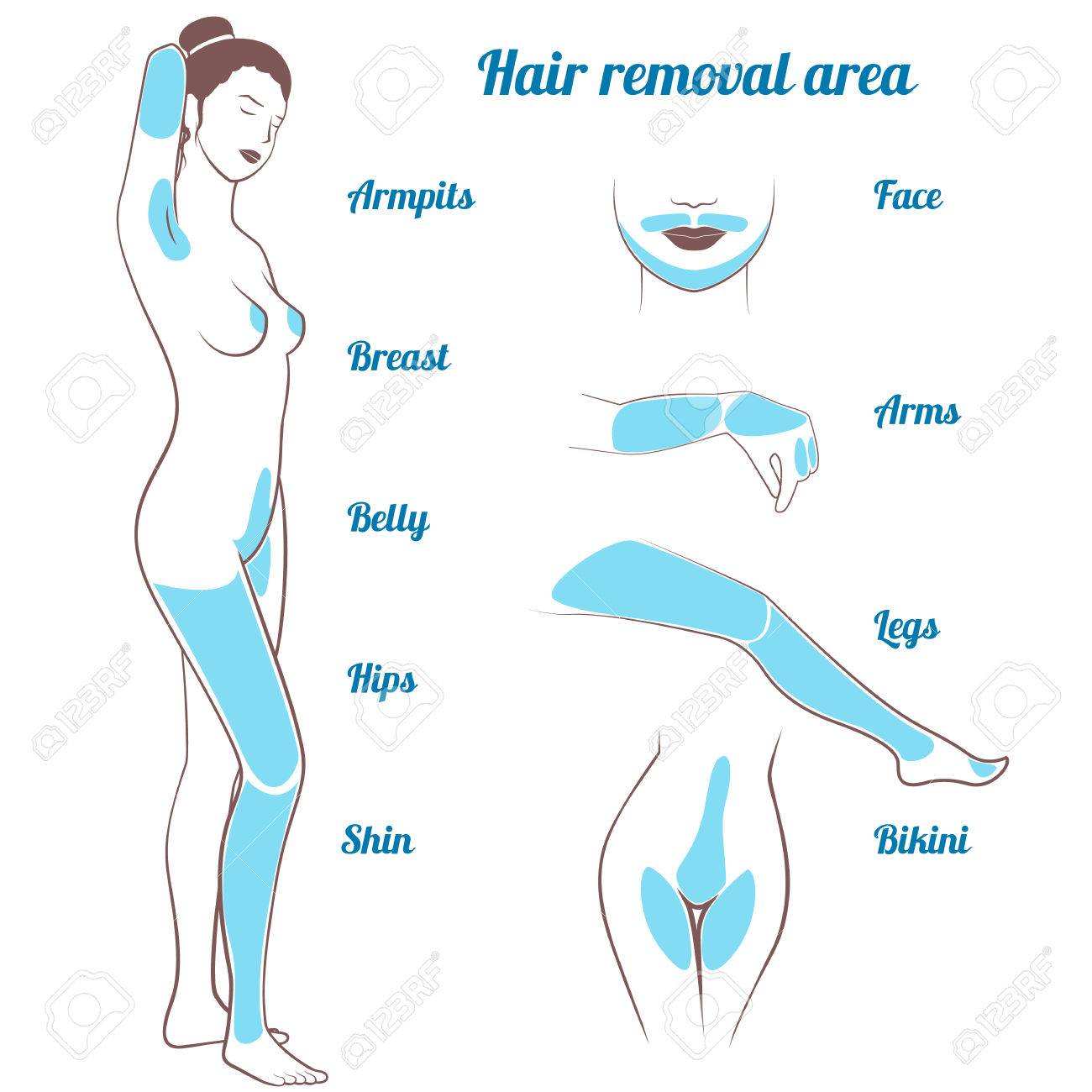 エリア脱毛 マーク ゾーン脱毛で完全な成長で裸の女の子のイラスト素材 ベクタ Image