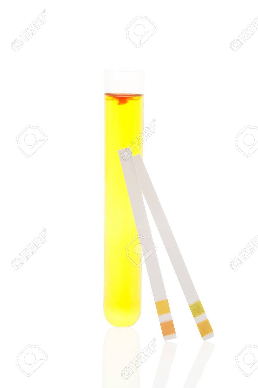 Lakmoespapier test zwangerschap