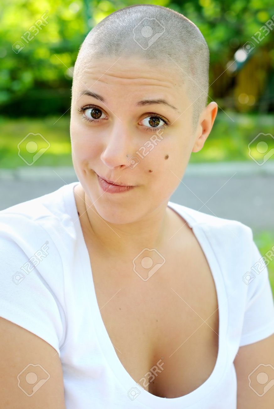Funny Hairless Girl, Outdoors Portrait Stock Photo, Picture And Royalty Free Image. Image 9955781. Funny Hairless Girl, Outdoors Portrait Stock Photo, Picture And Royalty Free Image. Image 9955781.
