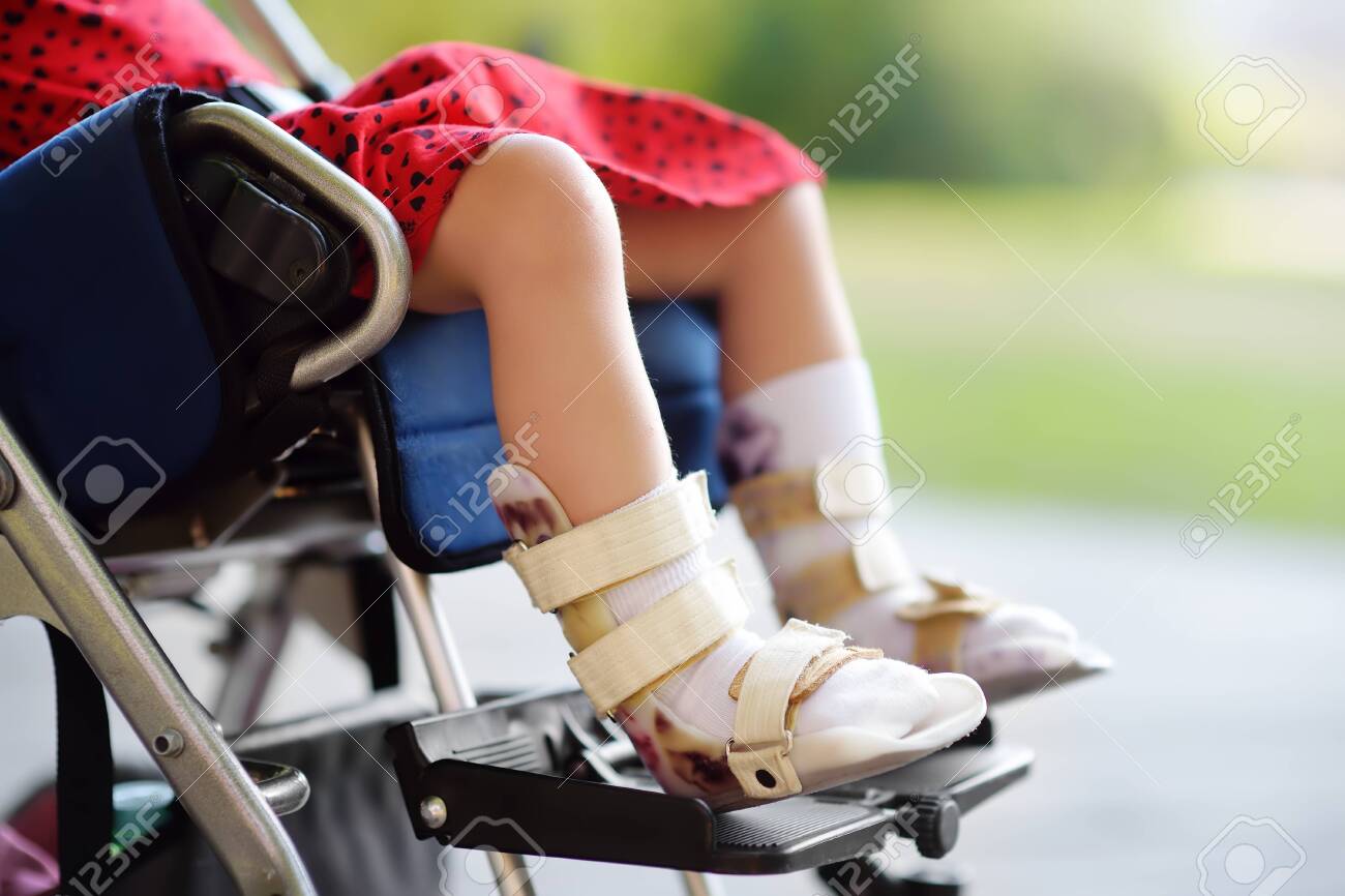 Disabled girl sitting in wheelchair. On her legs orthosis. Child cerebral palsy. Inclusion. Family with disabled kid. - 125414875 Disabled girl sitting in wheelchair. On her legs orthosis. Child cerebral palsy. Inclusion. Family with disabled kid. - 125414875
