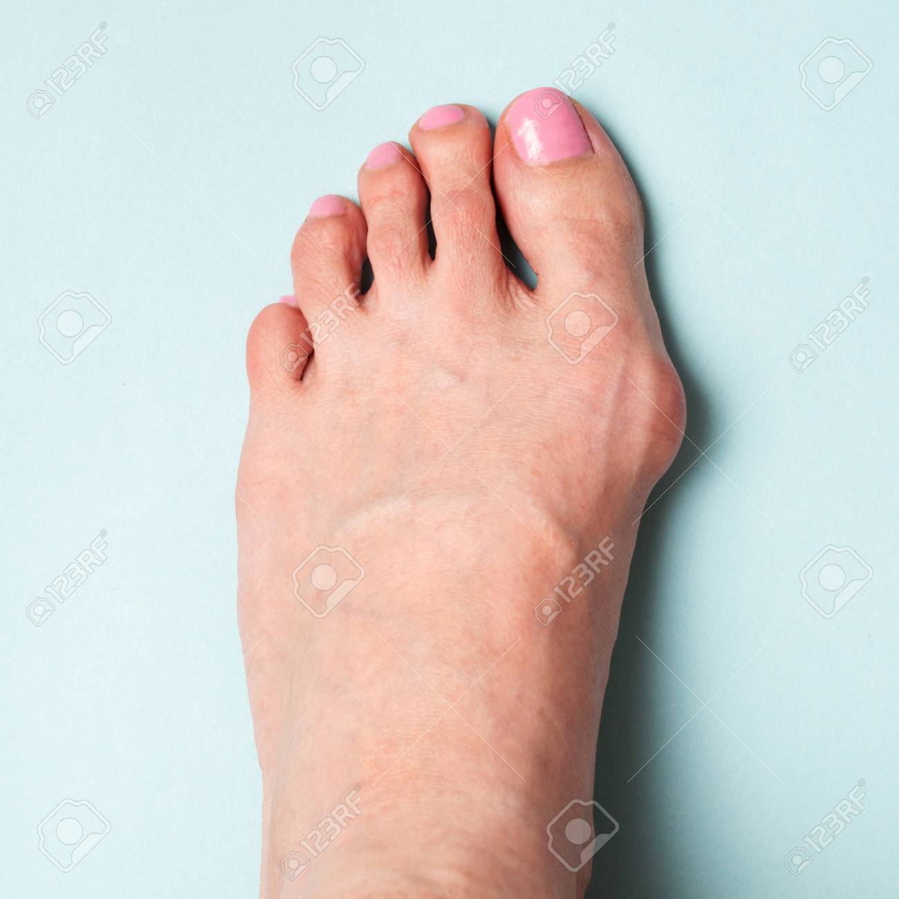 narrow foot