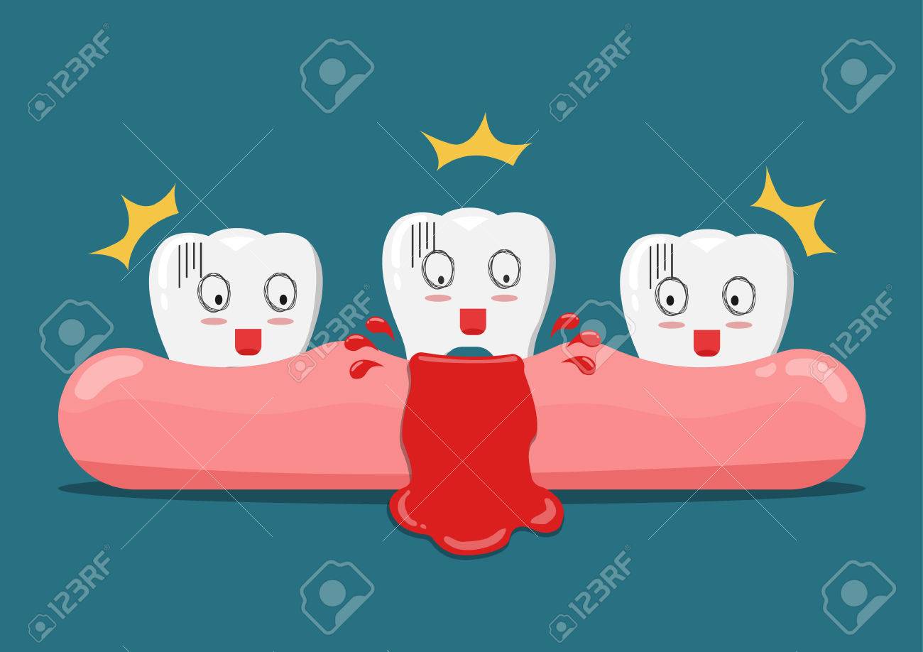 Vector Cartoon Teeth Feel Shock Because Gingivitis Blood ,dental Concept  Illustration. Royalty Free SVG, Cliparts, Vectors, And Stock Illustration.  Image 70109124.