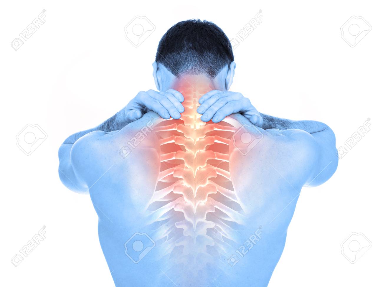Back pain - 74378072 Back pain - 74378072