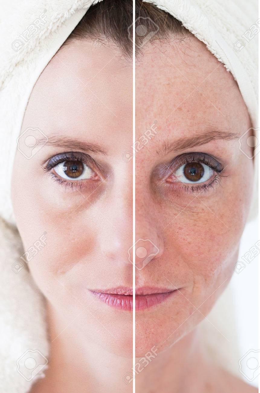Beauty concept - skin care, anti-aging procedures, rejuvenation, lifting, tightening of facial skin - 38470662 Beauty concept - skin care, anti-aging procedures, rejuvenation, lifting, tightening of facial skin - 38470662