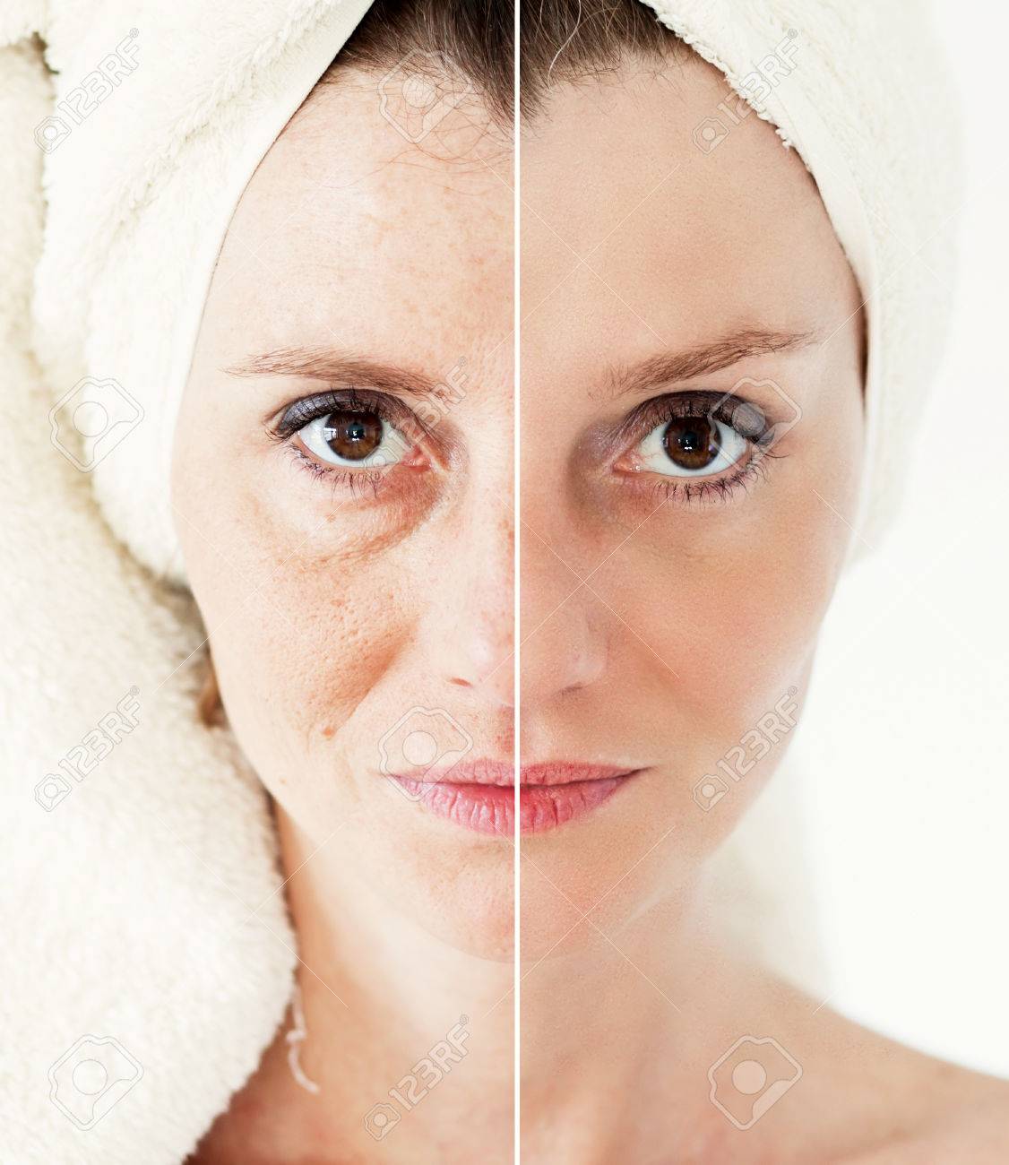 Beauty concept - skin care, anti-aging procedures, rejuvenation, lifting, tightening of facial skin - 39761836 Beauty concept - skin care, anti-aging procedures, rejuvenation, lifting, tightening of facial skin - 39761836