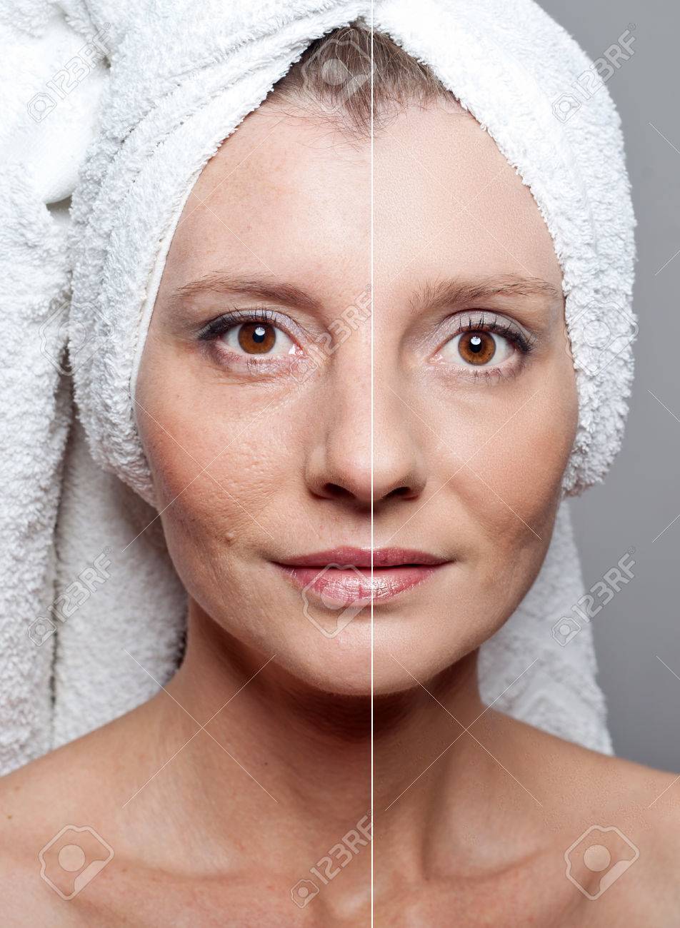 Beauty concept - skin care, anti-aging procedures, rejuvenation, lifting, tightening of facial skin - 47692982 Beauty concept - skin care, anti-aging procedures, rejuvenation, lifting, tightening of facial skin - 47692982