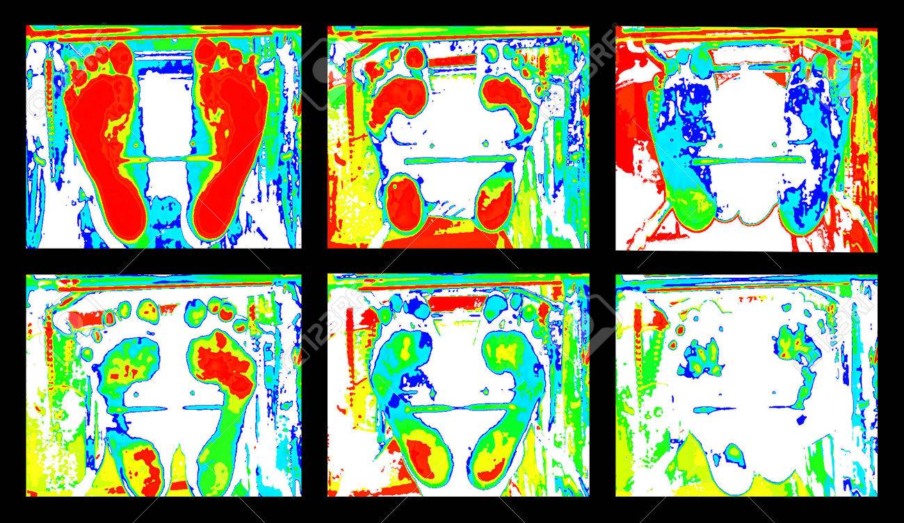 Podoskop Scanner Test Diabetes Fuss Lizenzfreie Fotos Bilder Und Stock Fotografie Image 67217953