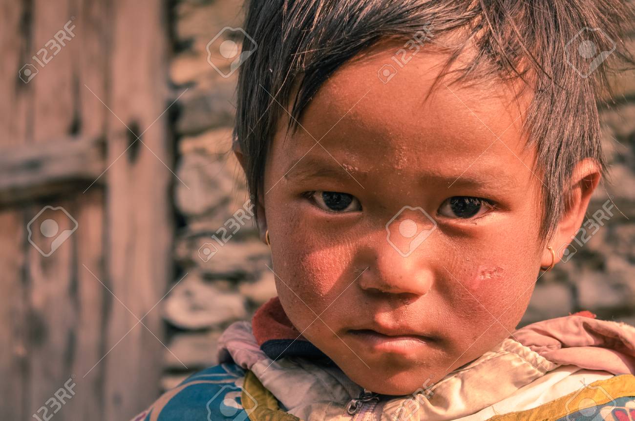 Beni Nepal Circa May 2012 Small Girl With Short Brown Hair