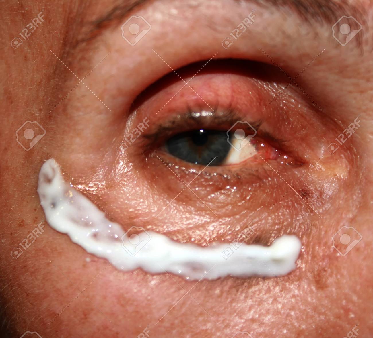 eyelid cream for wrinkles
