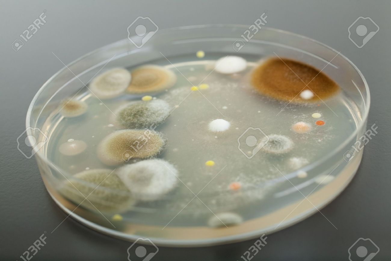Petri Dish With Agar And Bacterium Colony On Grey Table Top Stock Photo,  Picture and Royalty Free Image. Image 11617354.