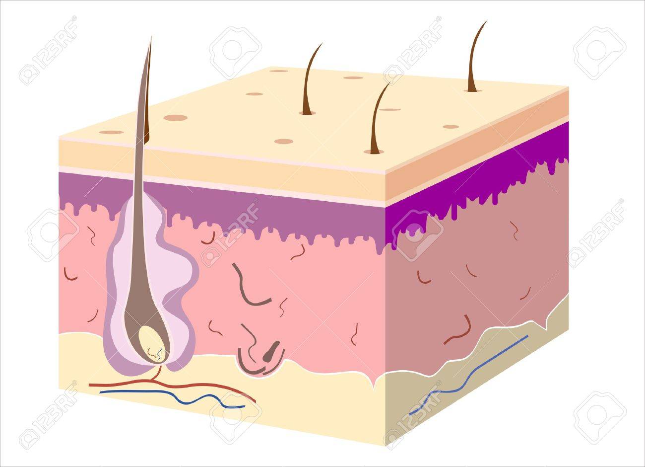 3D skin oblique with cut away epidermis - 17483915 3D skin oblique with cut away epidermis - 17483915