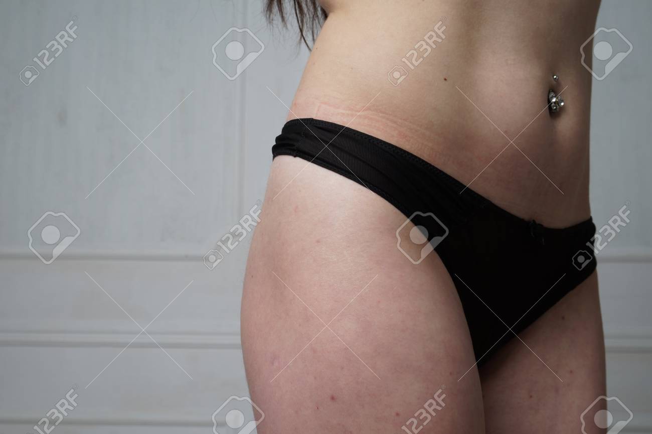 美しいスリムな女性の体 完璧なスリムは引き締まった少女の若い体です フィットネスや整形外科と審美的な美容 しっかりしたお尻 灰色の背景にポーズ黒いビキニでスポーティな女の子は の写真素材 画像素材 Image 美しいスリムな女性の体 完璧なスリムは引き締まった少女の若い体です フィットネスや整形外科と審美的な美容 しっかりしたお尻 灰色の背景にポーズ黒いビキニでスポーティな女の子は の写真素材 画像素材 Image