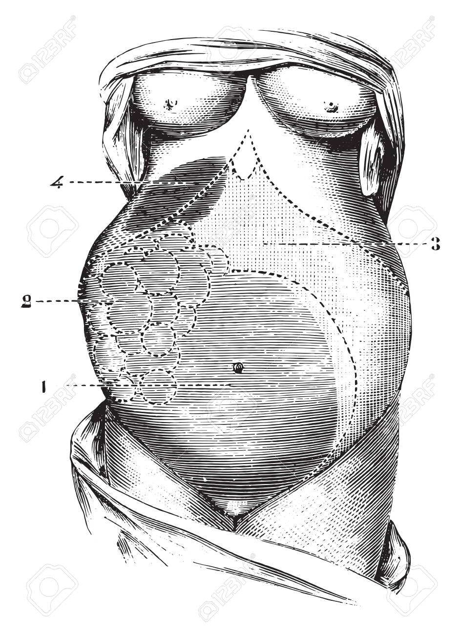 medicina del quiste
