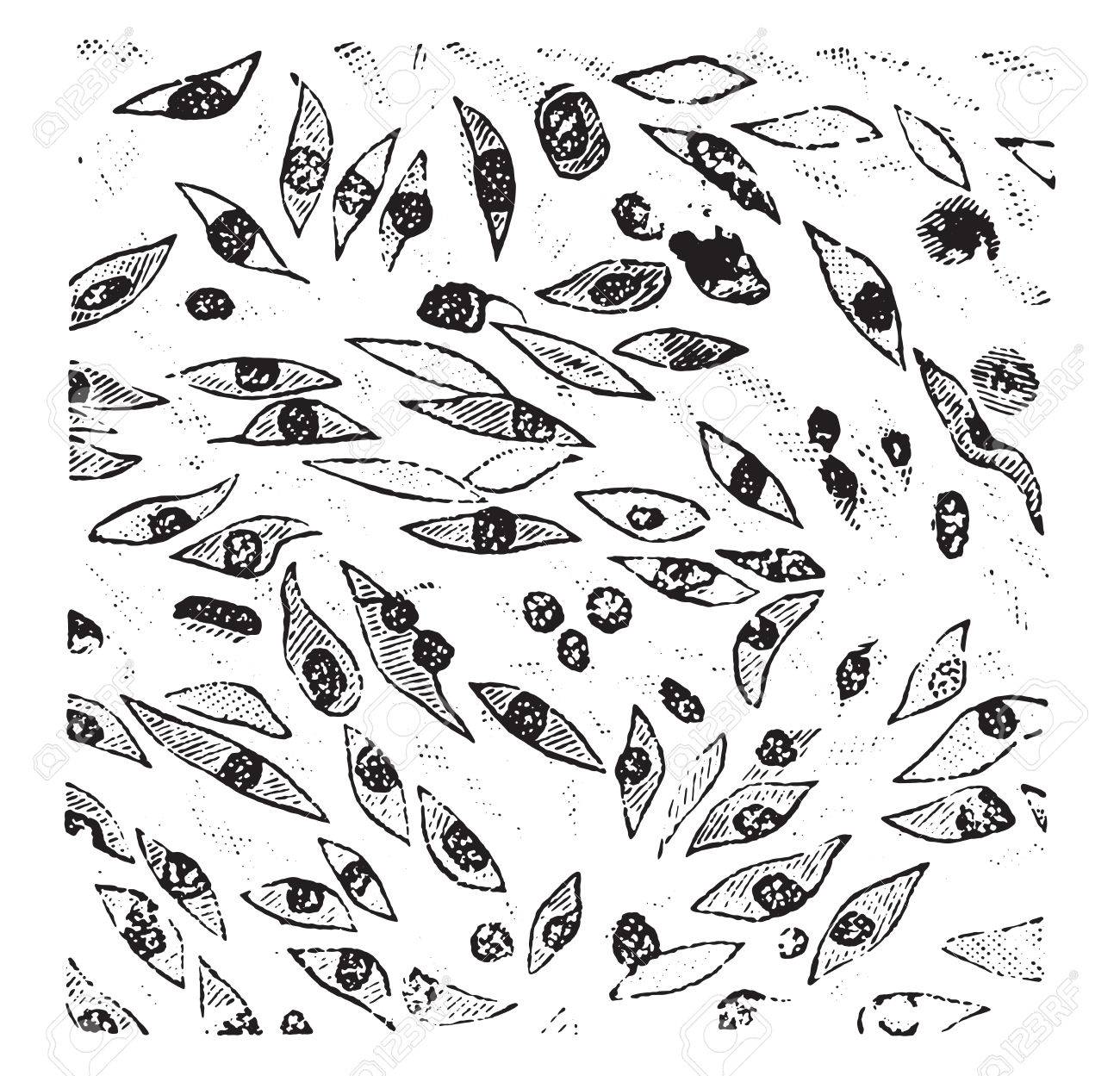 紡錘形細胞肉腫 ヴィンテージには 図が刻まれています のイラスト素材 ベクタ Image