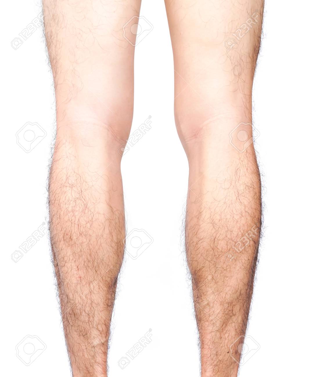 Closeup Back Of Legs Men Skin And Hairy With White Background, Health Care  And Medical Concept Stock Photo, Picture and Royalty Free Image. Image  86362407.