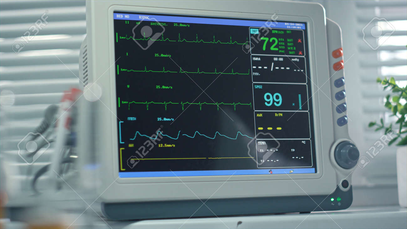 手術室のクローズアップで脈拍のバイタルサインを示す心拍モニター画面