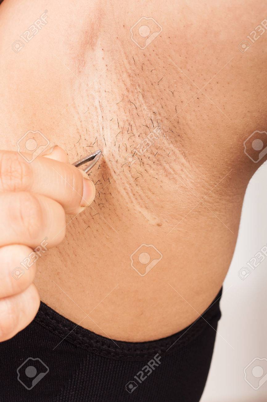 25 Top Pictures How To Remove Armpit Hair - Best Guide To Remove Armpit Hair Permanently Tested