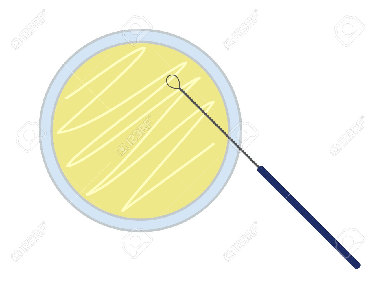Petri Dish With Nutrient Medium And Inoculation Loop Royalty Free ... for Inoculation Microbiology
45hul Petri Dish With Nutrient Medium And Inoculation Loop Royalty Free ... for Inoculation Microbiology
45hul