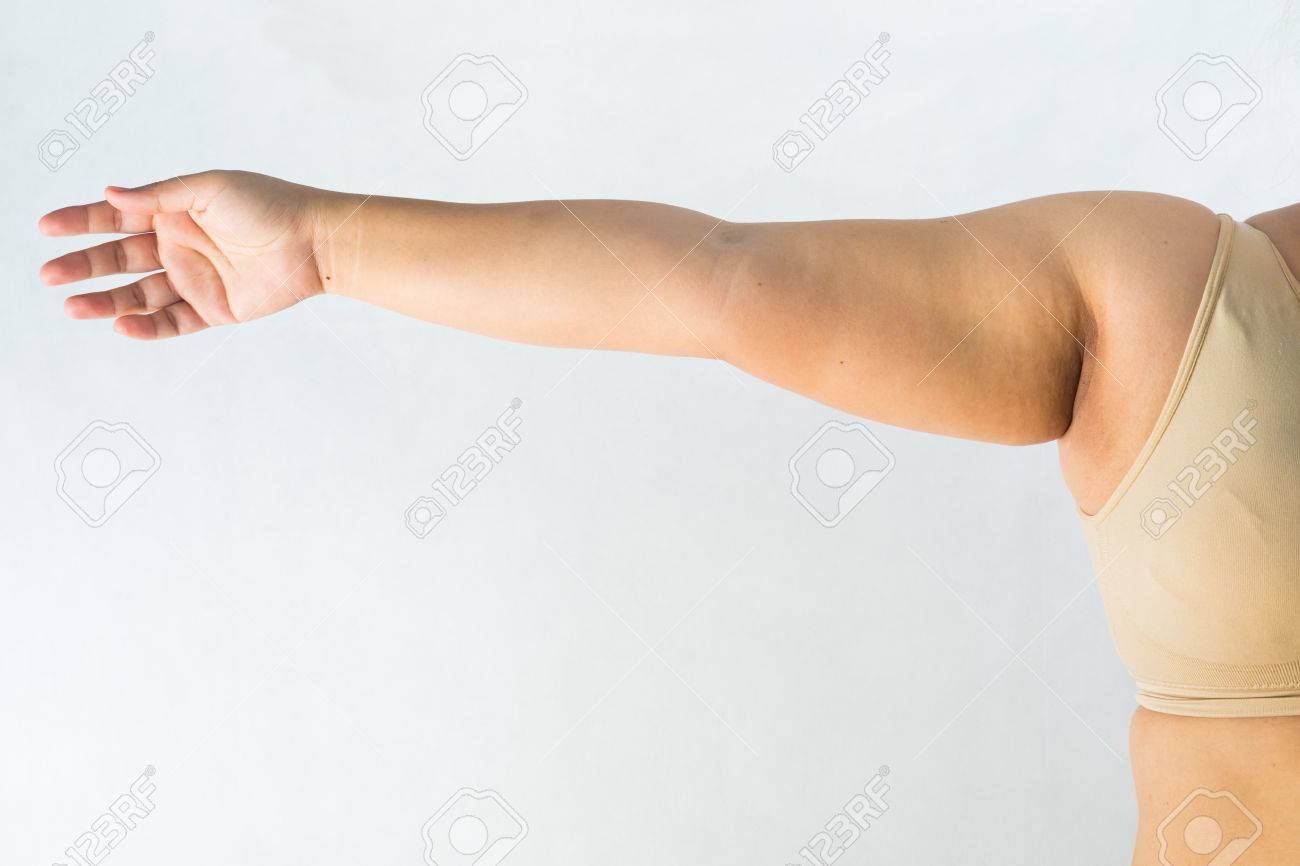 What to do with fat hands she lost weight, and for some reason her hands remained plump 27 What to do with fat hands she lost weight, and for some reason her hands remained plump 40