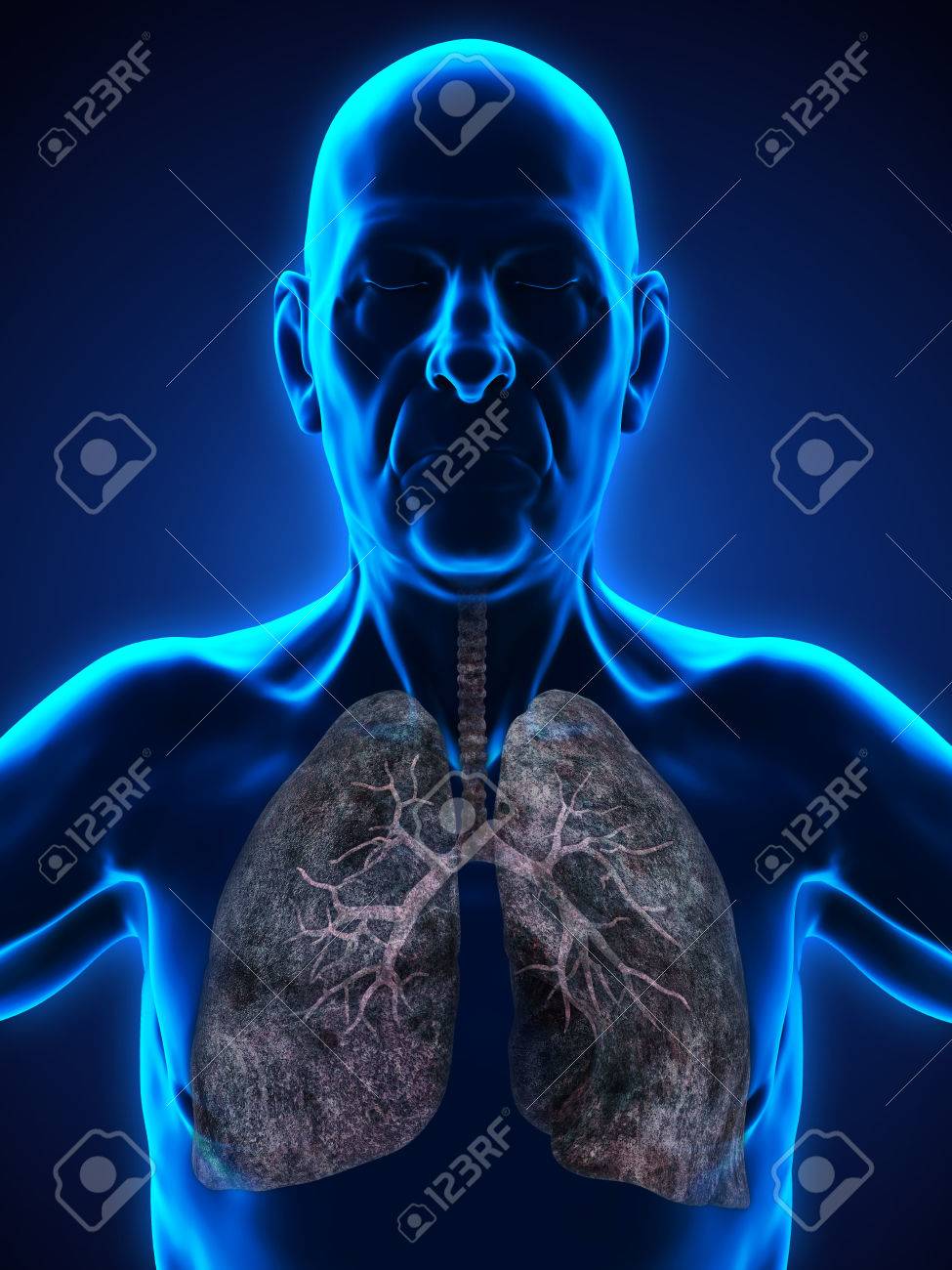 肺がんイラスト高齢者の男性 の写真素材 画像素材 Image