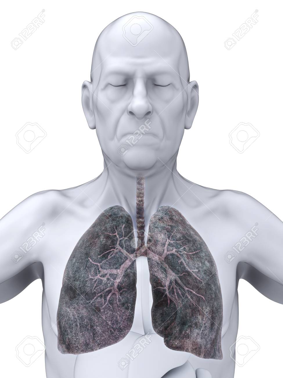肺がんイラスト高齢者の男性 の写真素材 画像素材 Image