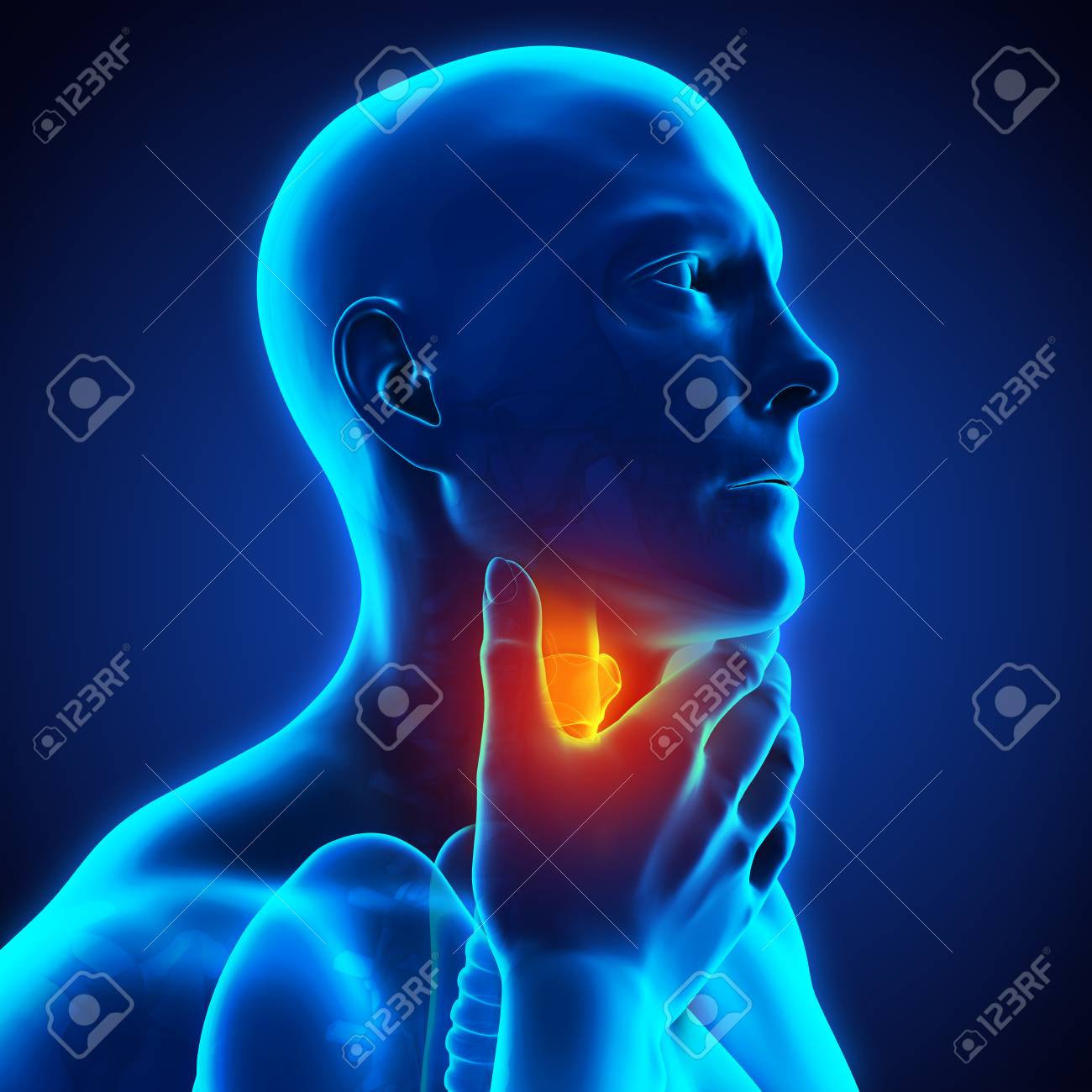 Sore Throat Illustration - 108182415 Sore Throat Illustration - 108182415
