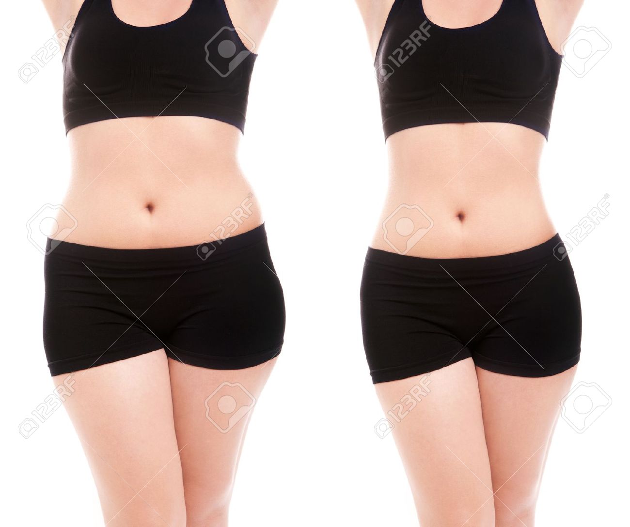 Woman s body before and after a diet - 16336466 Woman s body before and after a diet - 16336466