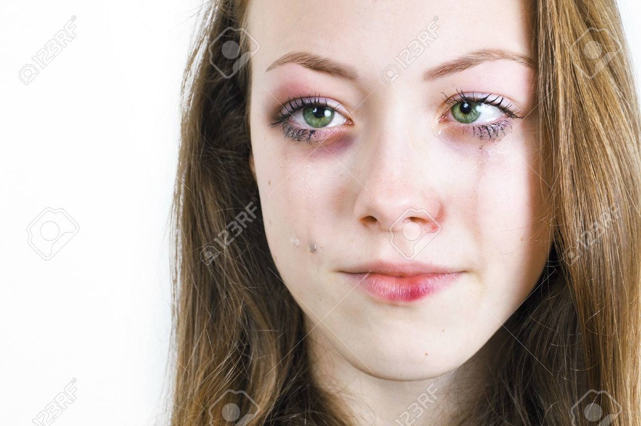 傷ついた皮膚や家庭内暴力による黒眼で泣いている女の子 の写真素材 画像素材 Image