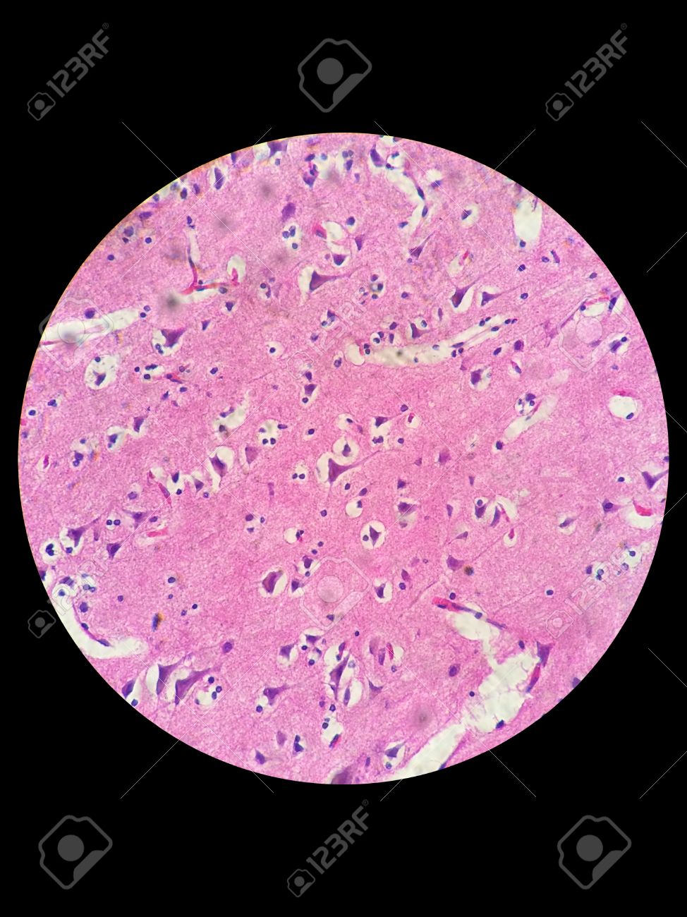 Les Cellules Nerveuses Sous Microscope Optique Des Cellules Nerveuses De La Moelle Epiniere Banque D Images Et Photos Libres De Droits Image Les Cellules Nerveuses Sous Microscope Optique Des Cellules Nerveuses De La Moelle Epiniere Banque D Images Et Photos Libres De Droits Image