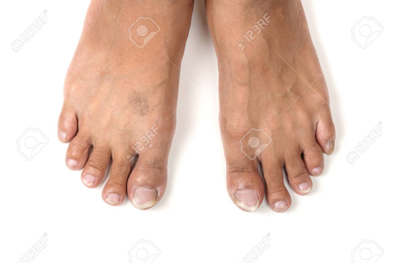 足 つま先と白い背景上の人間の足の爪 の写真素材 画像素材 Image