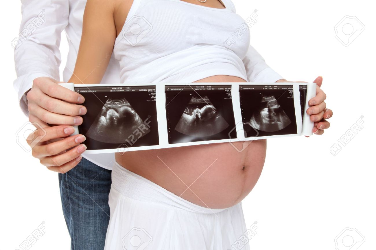 超音波を押し子を期待して妊娠しているカップル の写真素材 画像素材 Image 超音波を押し子を期待して妊娠しているカップル の写真素材 画像素材 Image