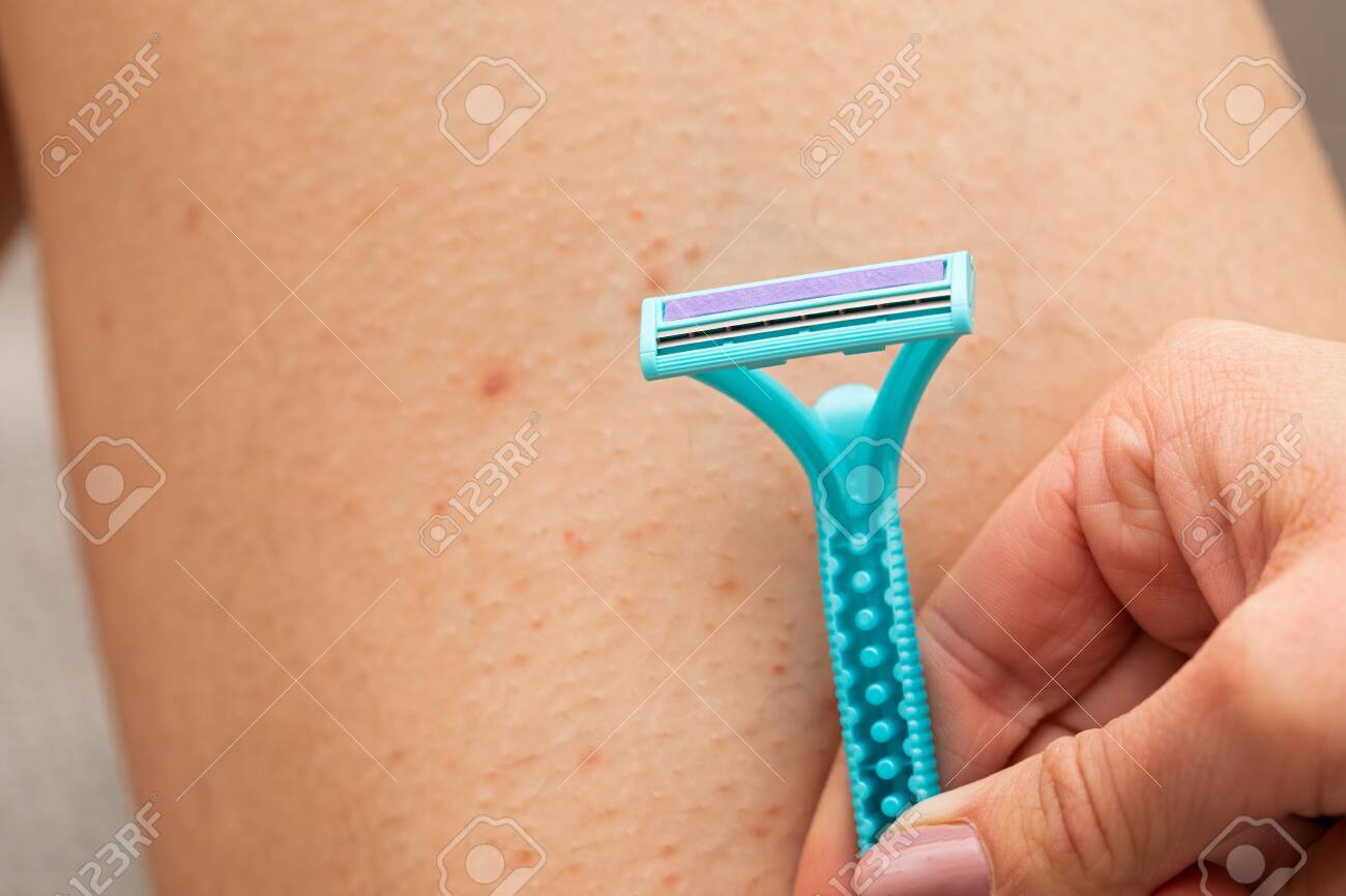 hairy shaving razor