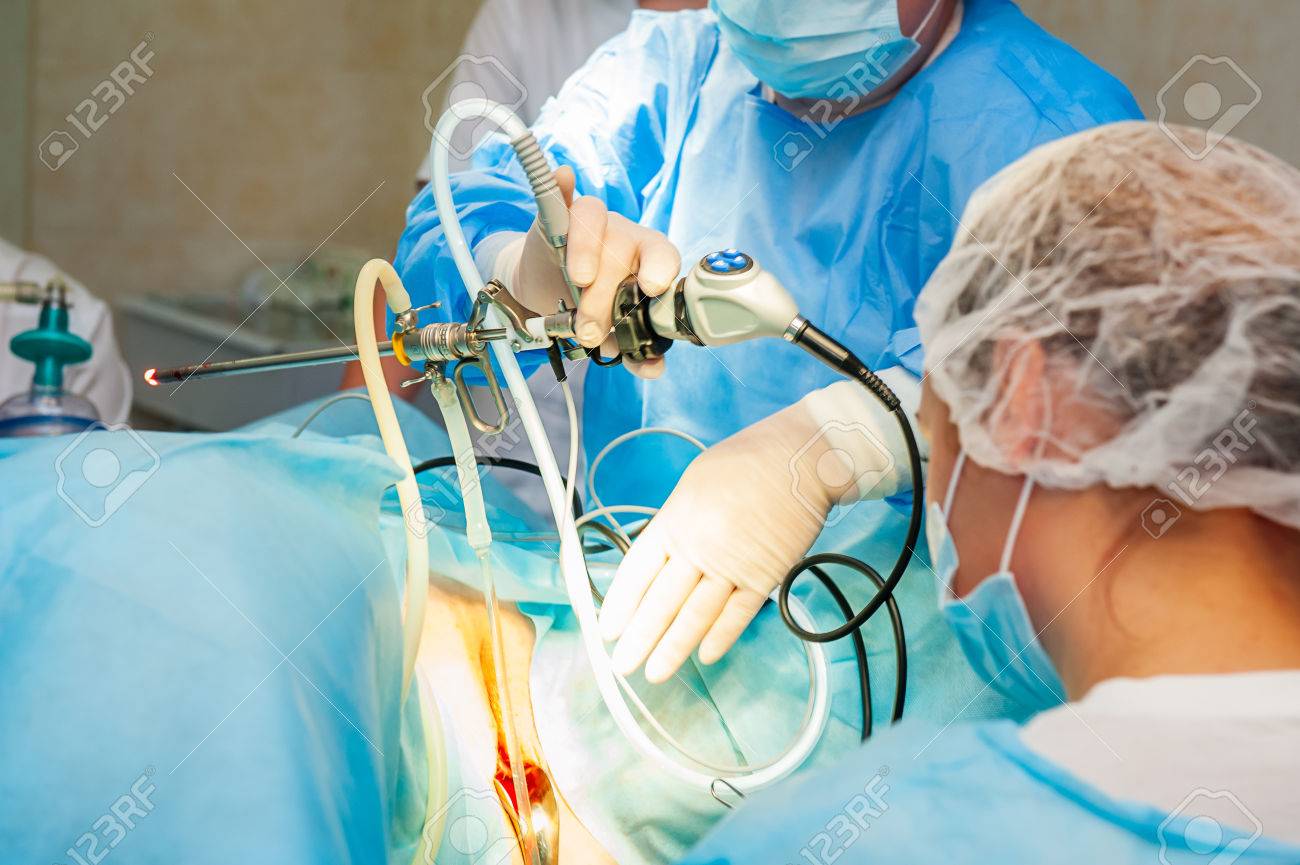 婦人科の手術操作を腹腔鏡機器を使用してのプロセス。の写真素材