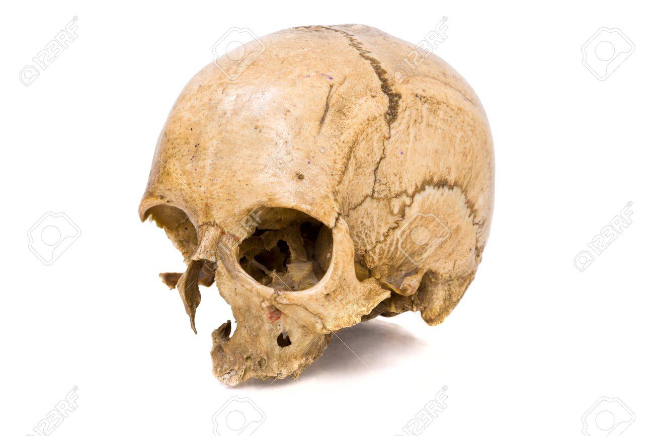 One Old Jawless Human Scull Isolated On White Stock Photo Picture And Royalty Free Image Image 5464689 One Old Jawless Human Scull Isolated On White Stock Photo Picture And Royalty Free Image Image 5464689