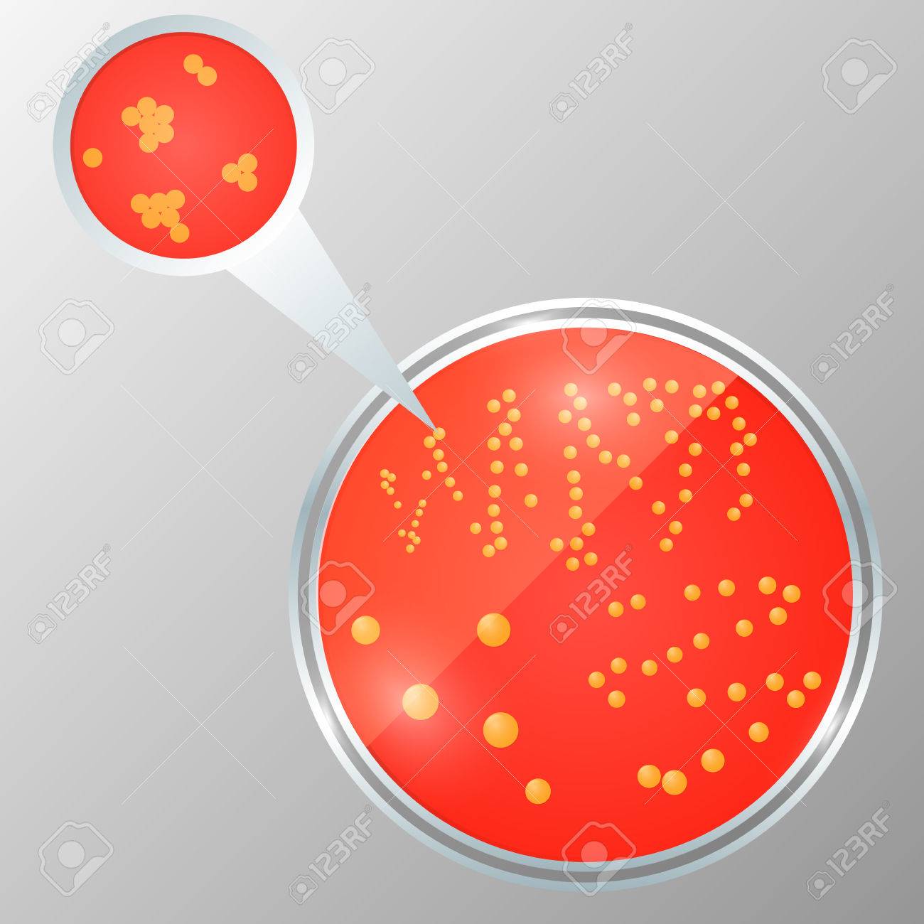 分離された細菌をシャーレの現実的なベクトル イラスト 寒天プレート上で黄色ブドウ球菌コロニー のイラスト素材 ベクタ Image
