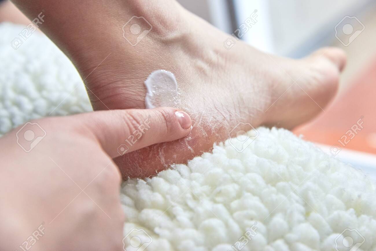 feet moisturizing cream
