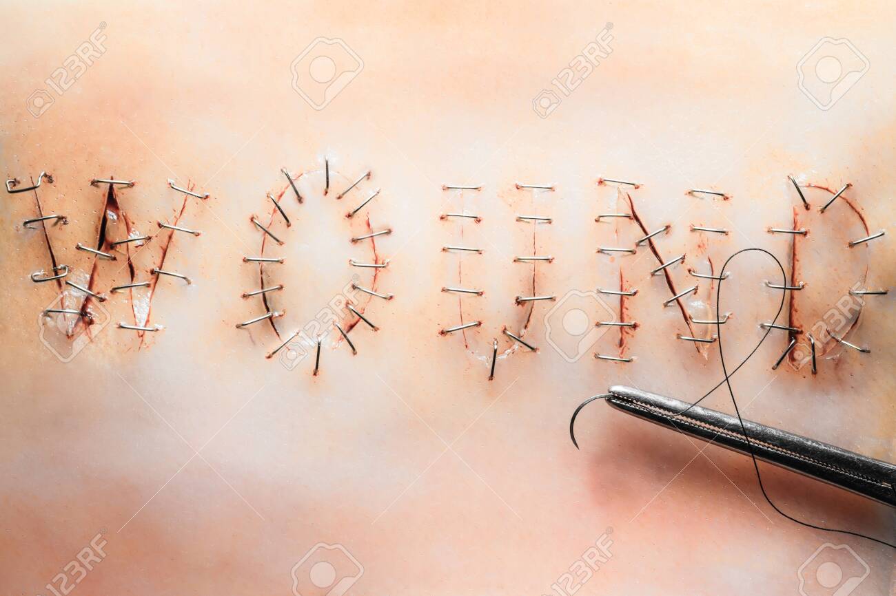 etiam-dictum-ipsum-a-felis