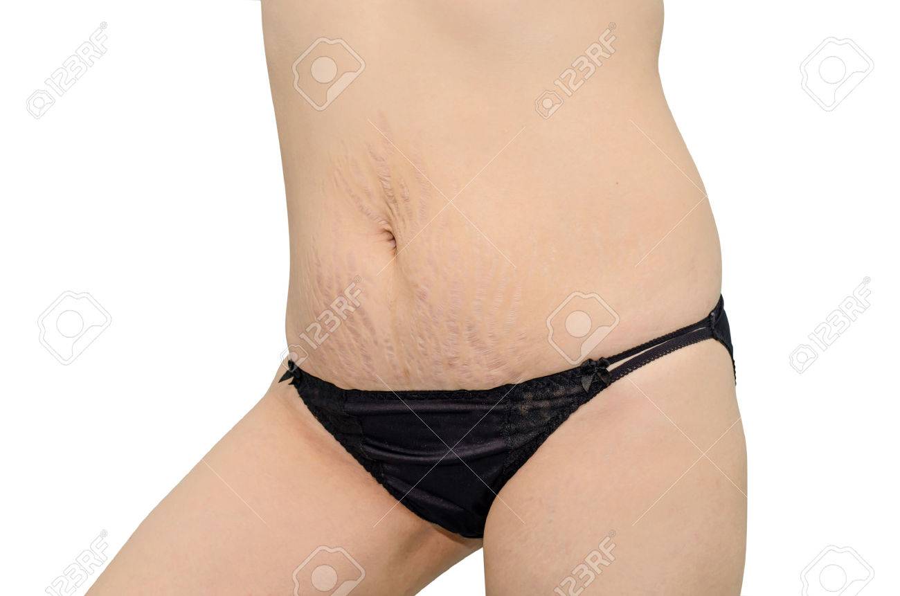 Mujer Asiática En Ropa Interior Negro Sus Estrías Fotos, Retratos, Imágenes Y Fotografía De Archivo Libres De Derecho. Image 32641749.